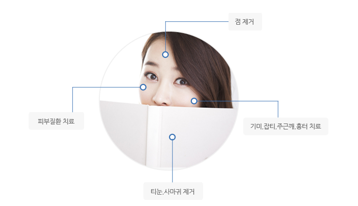 점제거/피부질환치료/기미,잡티,주근깨,흉터치료/티눈,사마귀제거